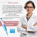 Caneta Removedora de Verrugas (acrocórdons)